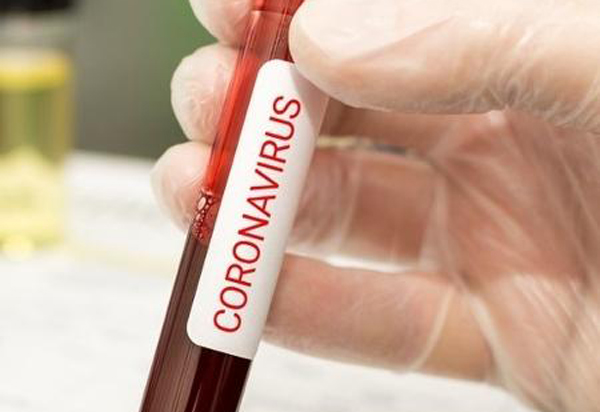 Bahia registra 33 casos confirmados de Covid-19