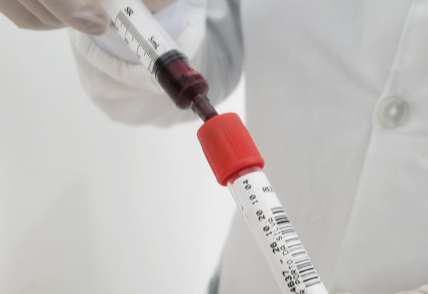 Mortes por covid-19 caem 8% e casos, 5%, informa boletim