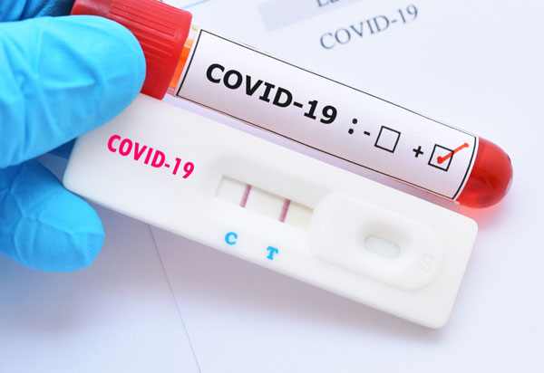 Covid-19: Somente 10% da população brasileira fez teste para detectar doença 
