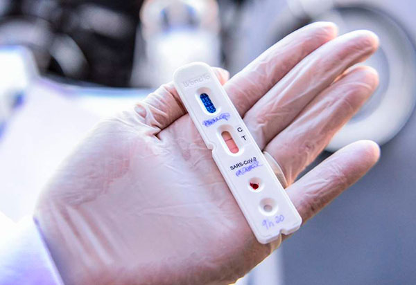 Secretaria da Saúde irá adquirir 50 mil testes rápidos de antígeno para detecção do coronavírus