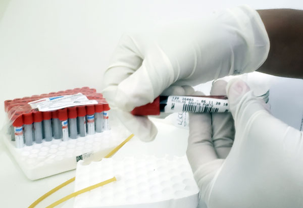 Bahia não tem circulação de variante indiana da Covid-19 