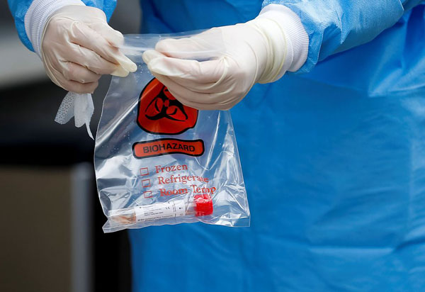 Covid-19: estudo indica que maioria de infectados cria anticorpos