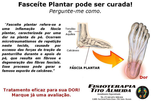 Fisioterapia Tito Almeida - Atendimento Especializado