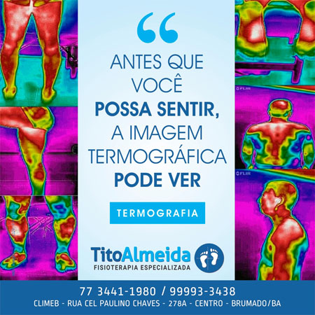 Fisioterapia Tito Almeida - Avaliação Termográfica