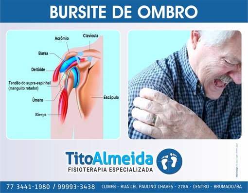 Tito Almeida - Fisioterapia Especializada