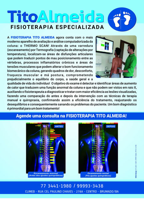 Fisioterapia Tito Almeida - Palmilhas Posturais