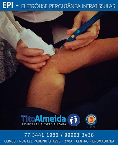 Tito Almeida - Fisioterapia Especializada