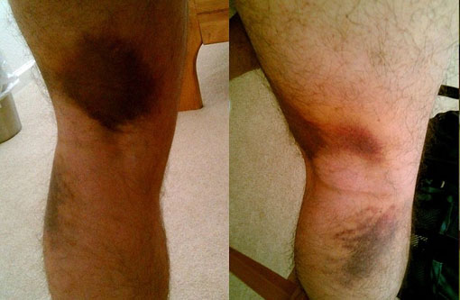 Fisioterapia Tito Almeida - Atendimento Especializado