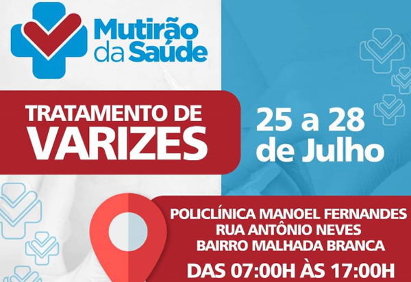 Brumado: de 25 a 28 serão realizados gratuitamente tratamentos de varizes na Policlínica Manoel Fernandes