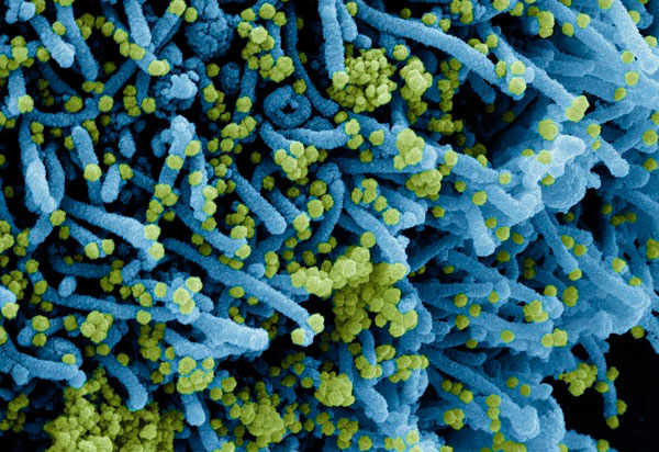 Descoberta nova variante do coronavírus com grande número de mutações