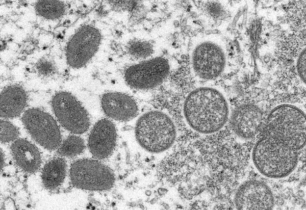 Brasil registra terceiro caso de varíola dos macacos